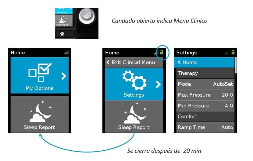 airsense-10-caracteristicas-6.jpg